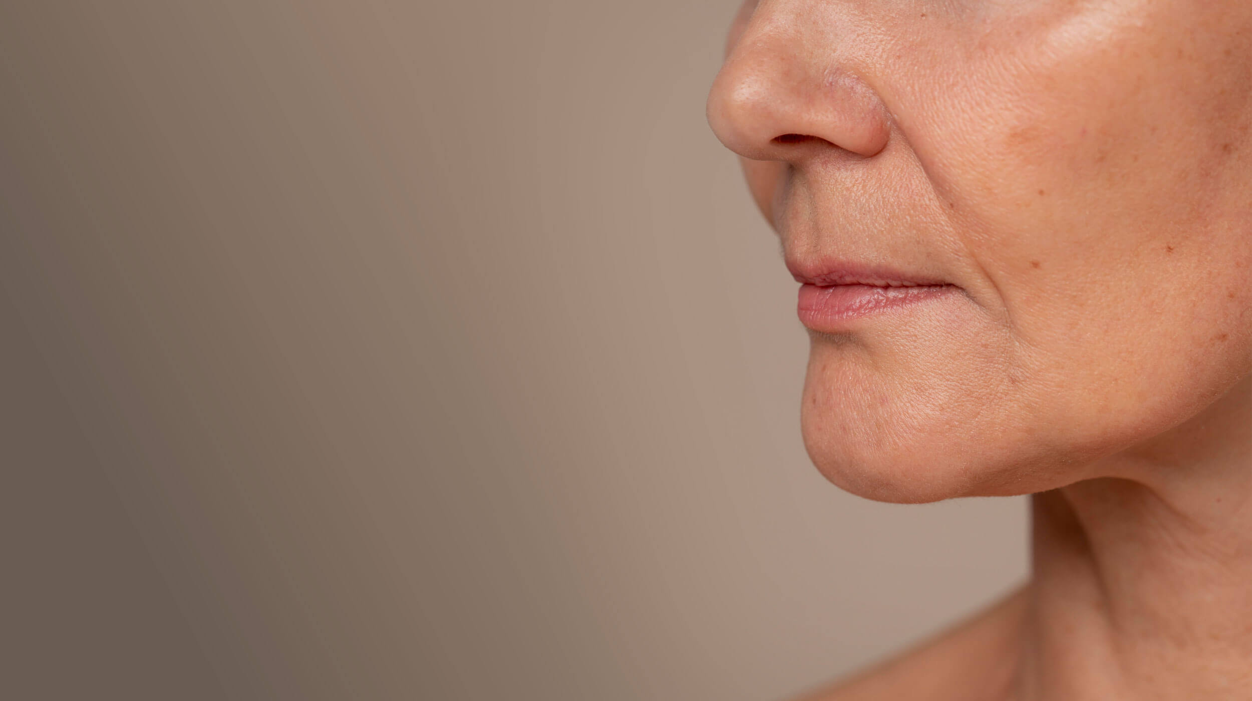 Κοντινό πλαϊνό πλάνο γυναικείου προσώπου, με εμφανή απώλεια όγκου στην περιοχή γύρω από το πηγούνι και τα μάγουλα. 