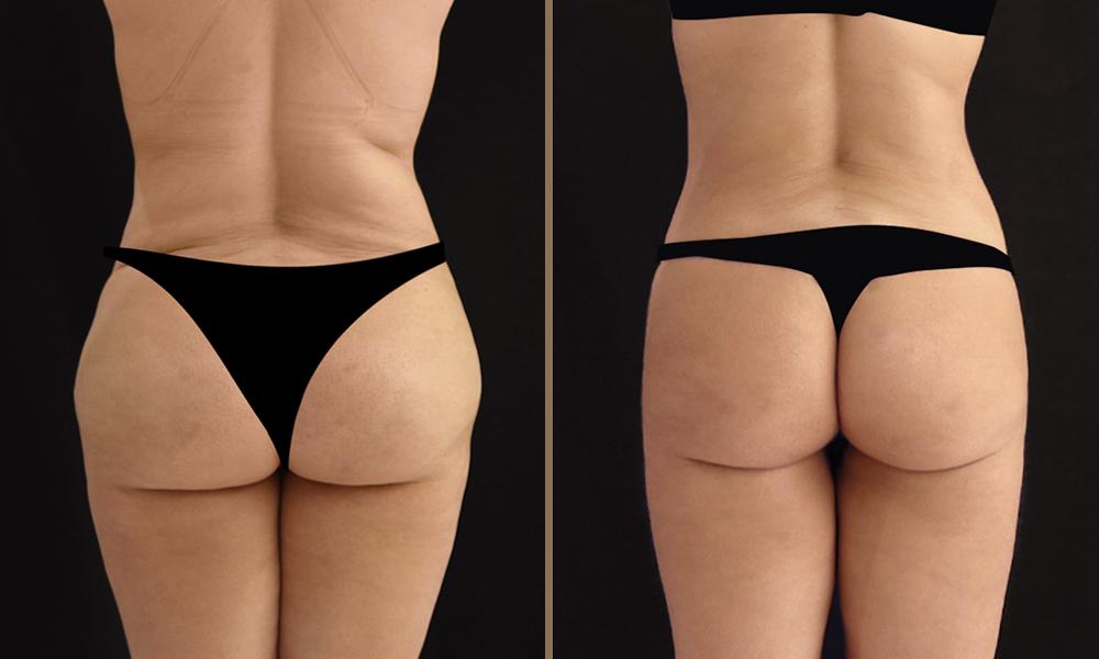 4D HD_ 018 woman anagnostopoulou