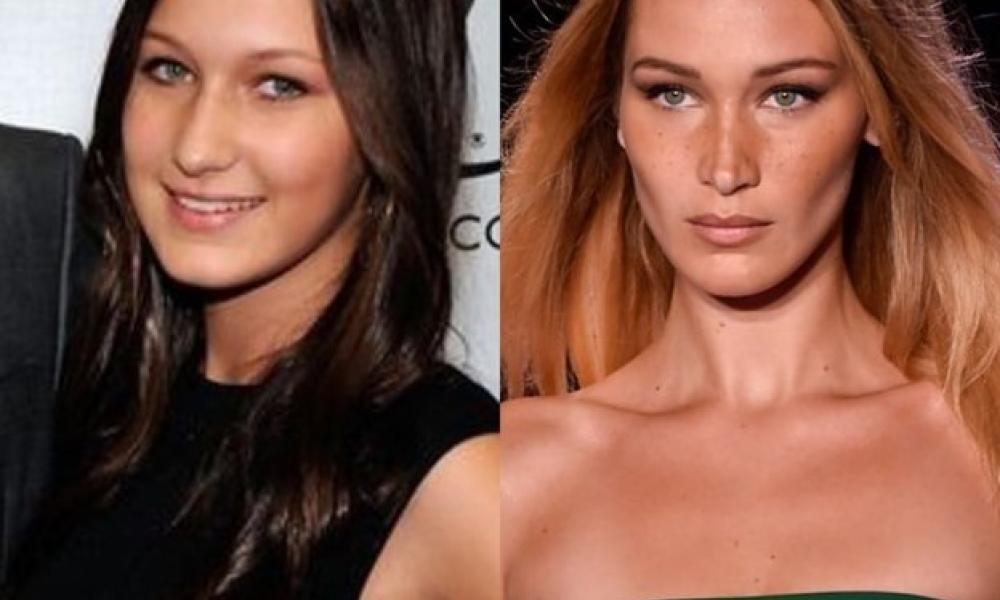 ABH Beautification before after