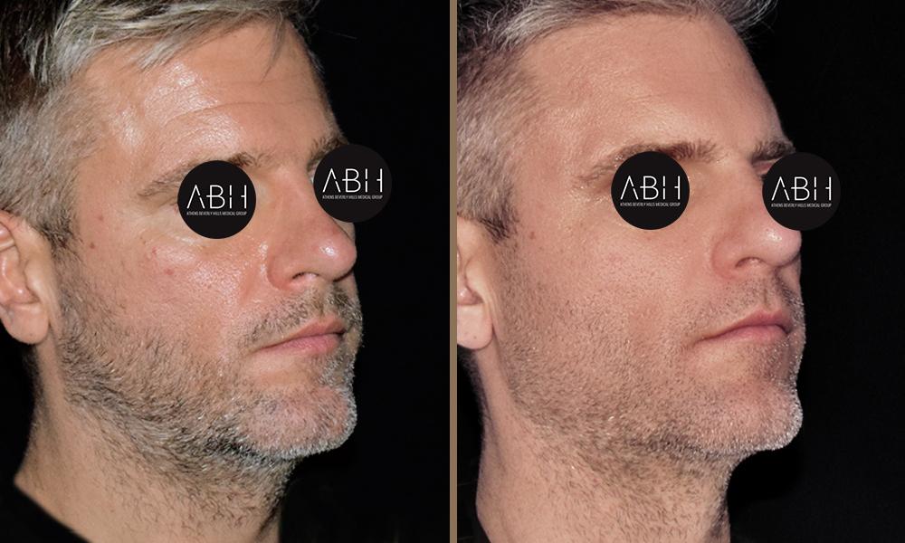 Beau_D_Fill florence-chris B