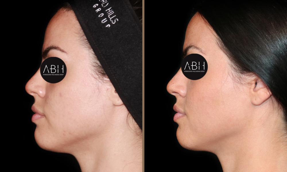 Beau_D_Fill  gerontati C