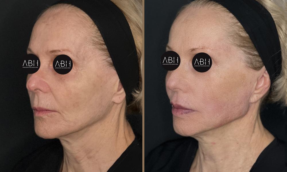 Beau_D_Fill ioannafatsea