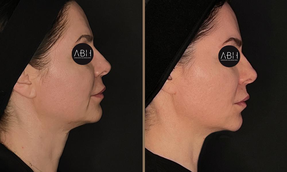 Dlift papadimitriou 3