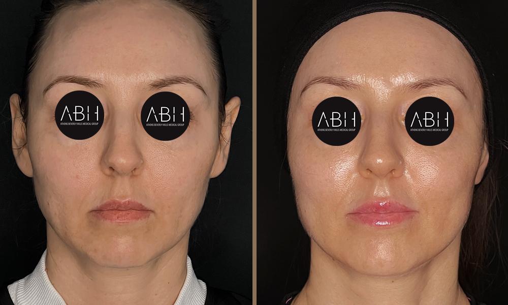 Beau_D_Fill papadopoulou A