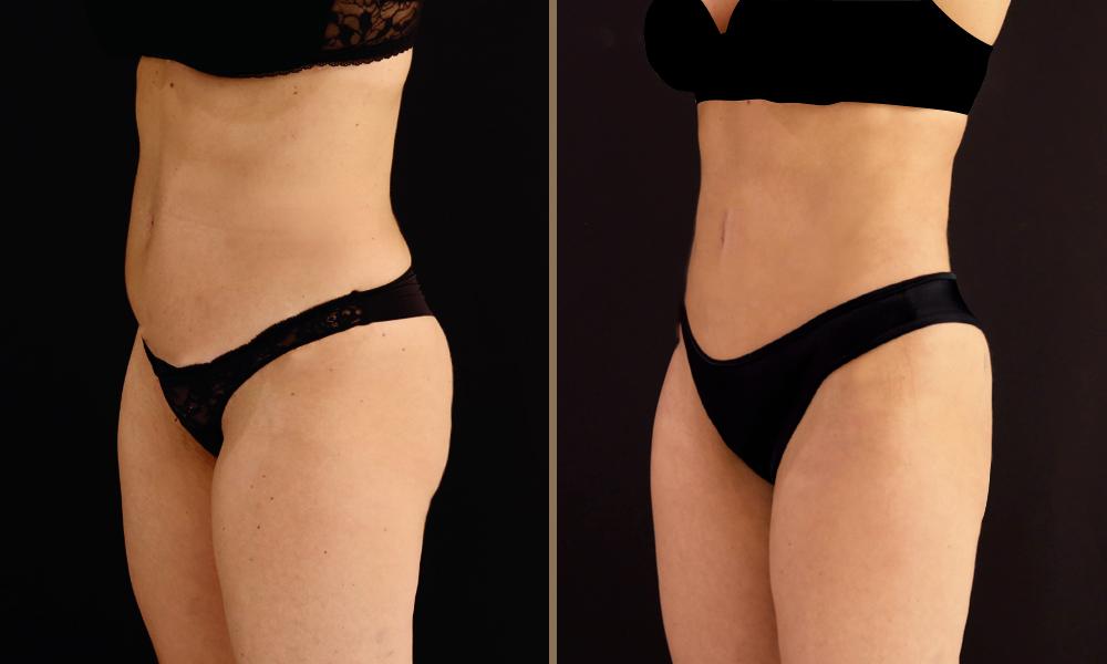 vaser-lipoandritsopoulou-marilena-b