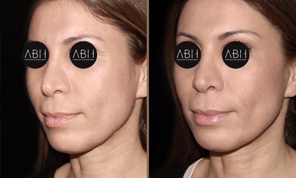 Beau_D_Fill vasilikaki C