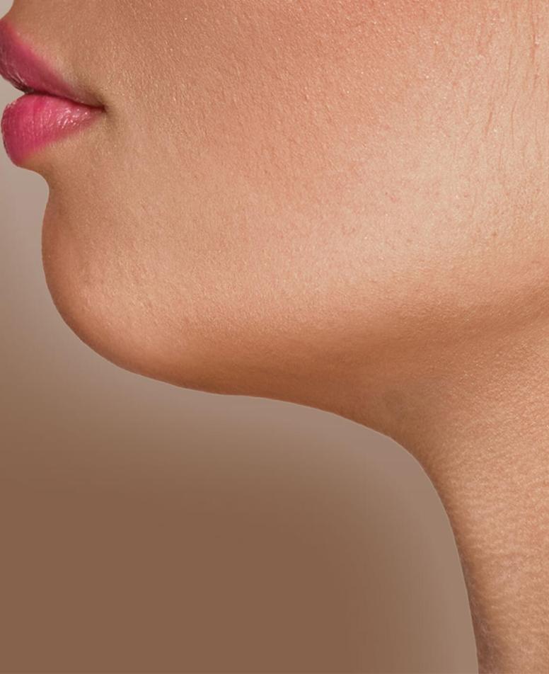 υπογναθισμός